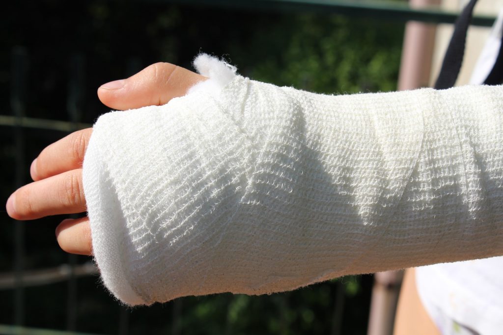 Hand In A Cast Irish National Orthopaedic Register - IITOS